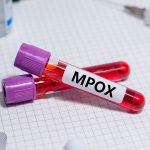 Mpox infection higher among males in Nigeria - NCDC