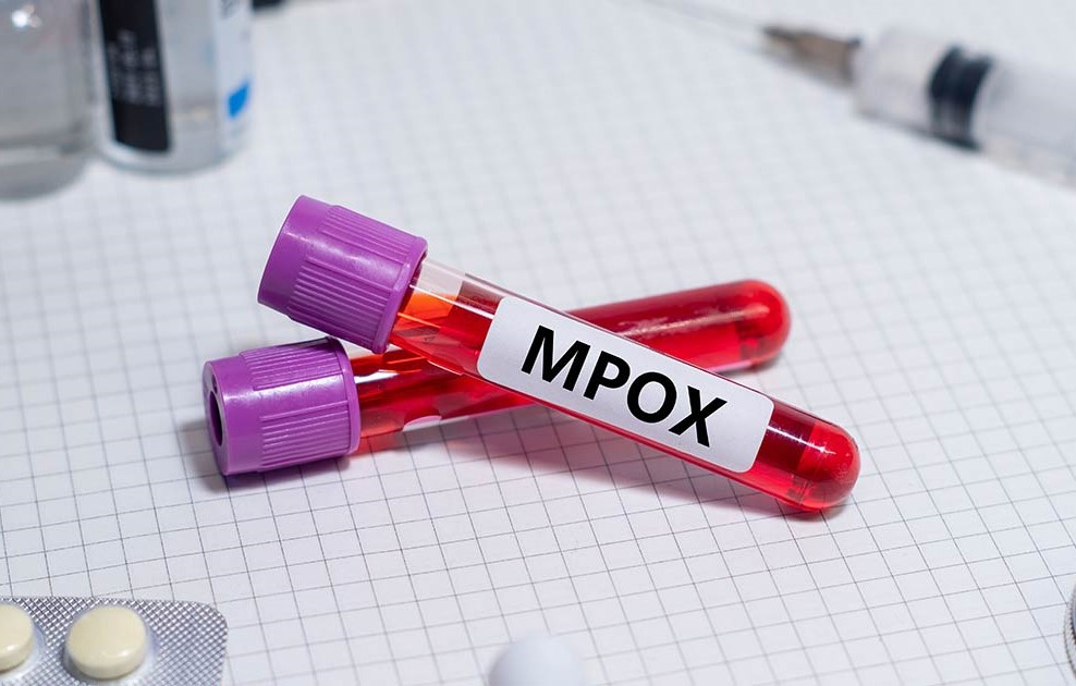 Mpox infection higher among males in Nigeria - NCDC